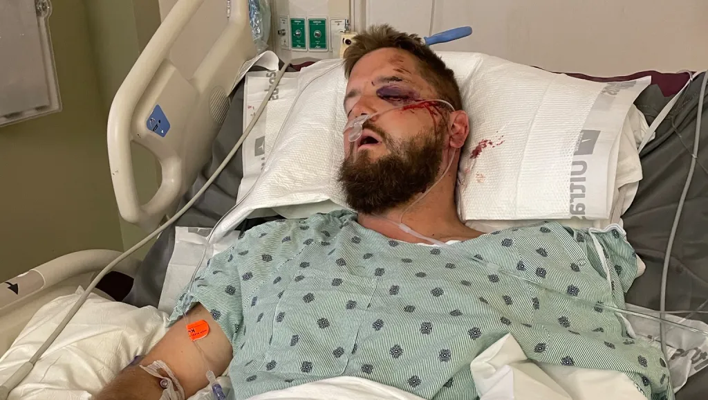Aric Hutchinson recovering in a hospital bed with injuries to his face, after being hit by an alleged drunk driver after his wedding.